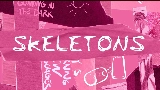 Videominiatuur Skeletons